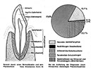 %_tempFileName69_01_Parodontose%